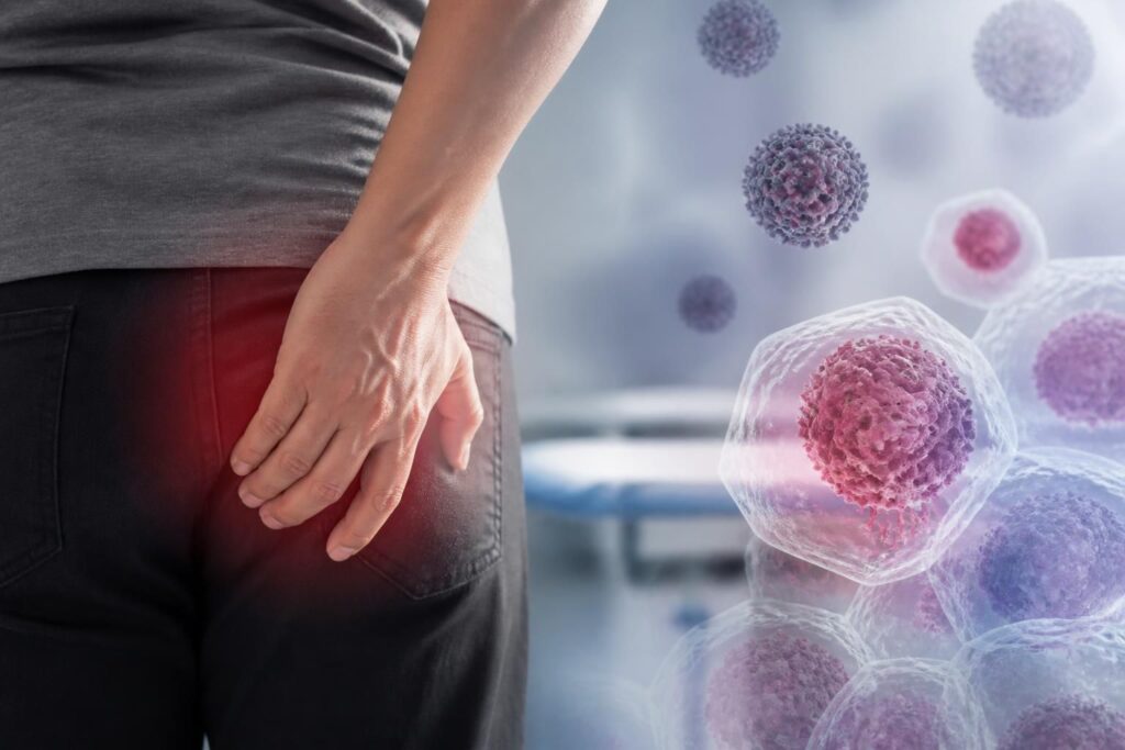 découvrez les symptômes du cancer de l'anus, apprenez à reconnaître les signes précoces et comprenez les causes pour agir rapidement et efficacement.